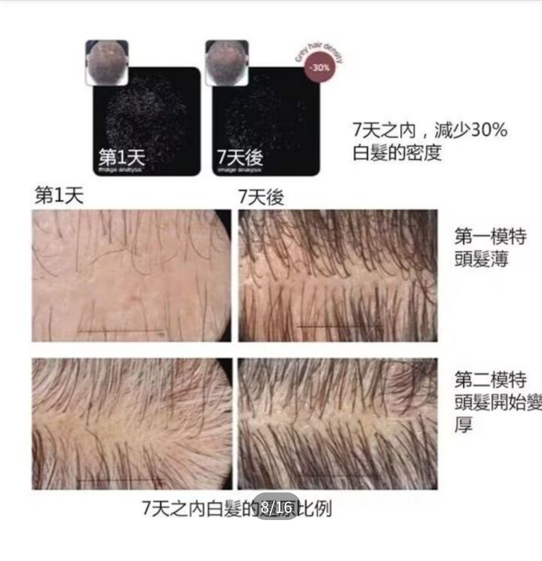 韓國 VT PDRN Reedle Shot 700dL 頭皮護理精華 15ml | 700微針導入 | PDRN強效育髮 | 防脫密髮