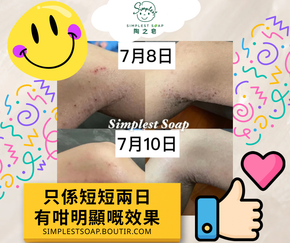 ❤️只係短短兩日有咁明顯嘅效果