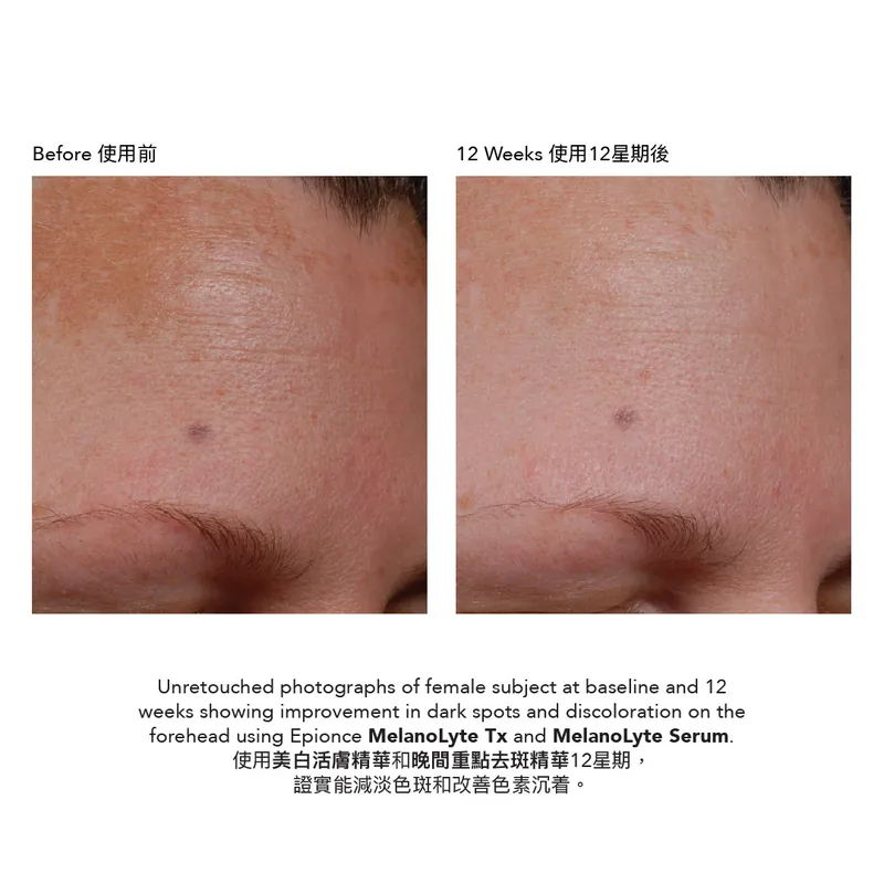 Epionce MelanoLyte Tx Brightening Lotion 美白活膚精華
