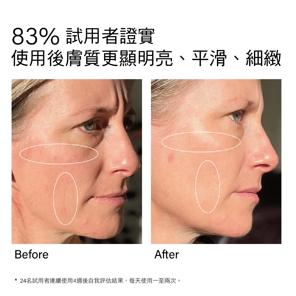 紐西蘭 Trilogy All-in-One 維他命C+超級精華液 30ml