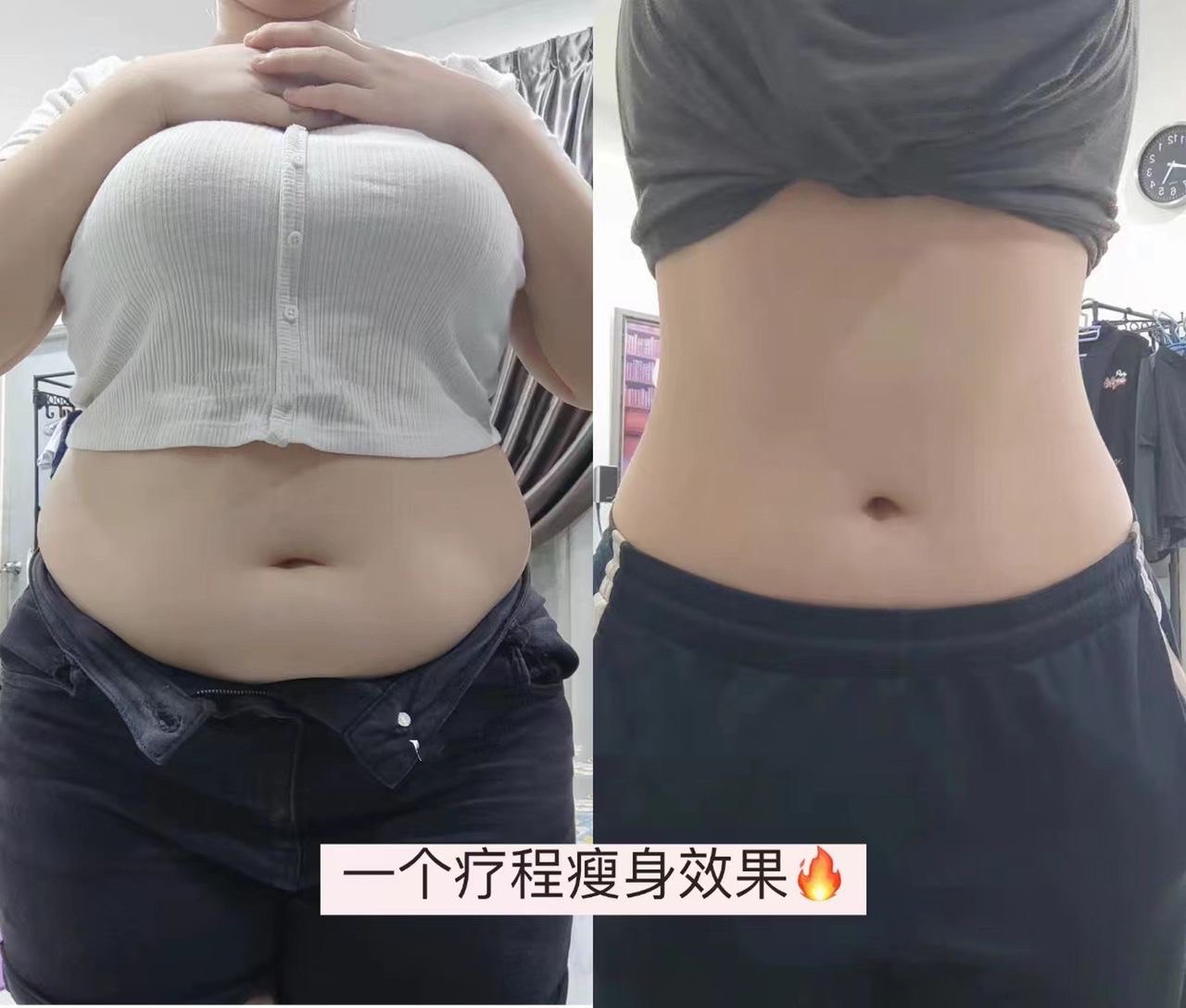 🇲🇾 5 盒 完整一个疗程配套 （ 可服用 30-45 天 ）