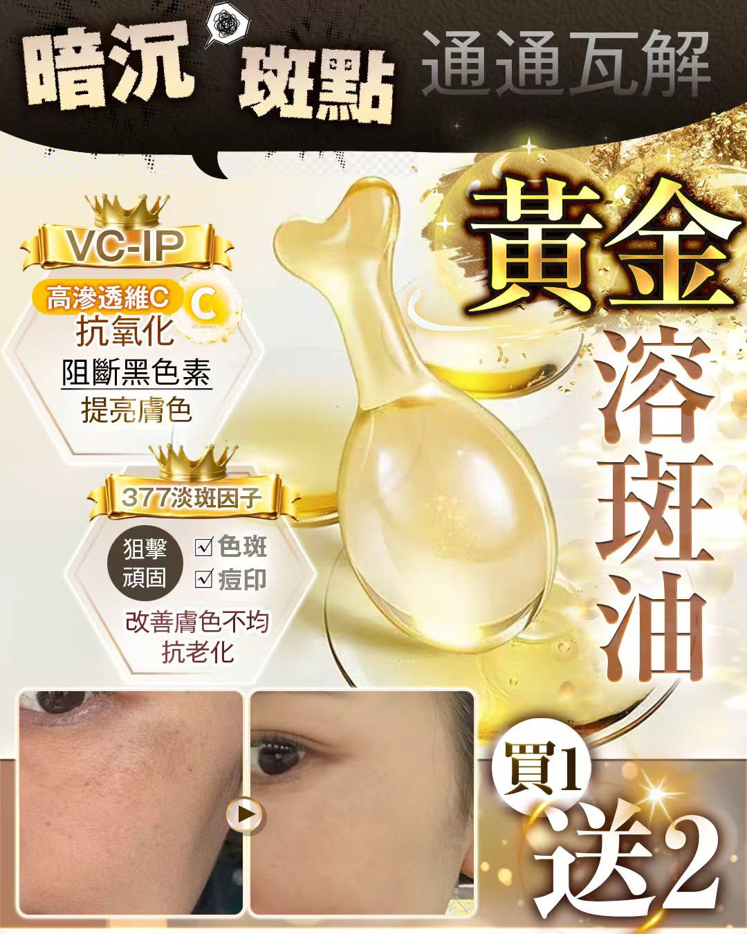 GV溶斑油(1盒10粒)