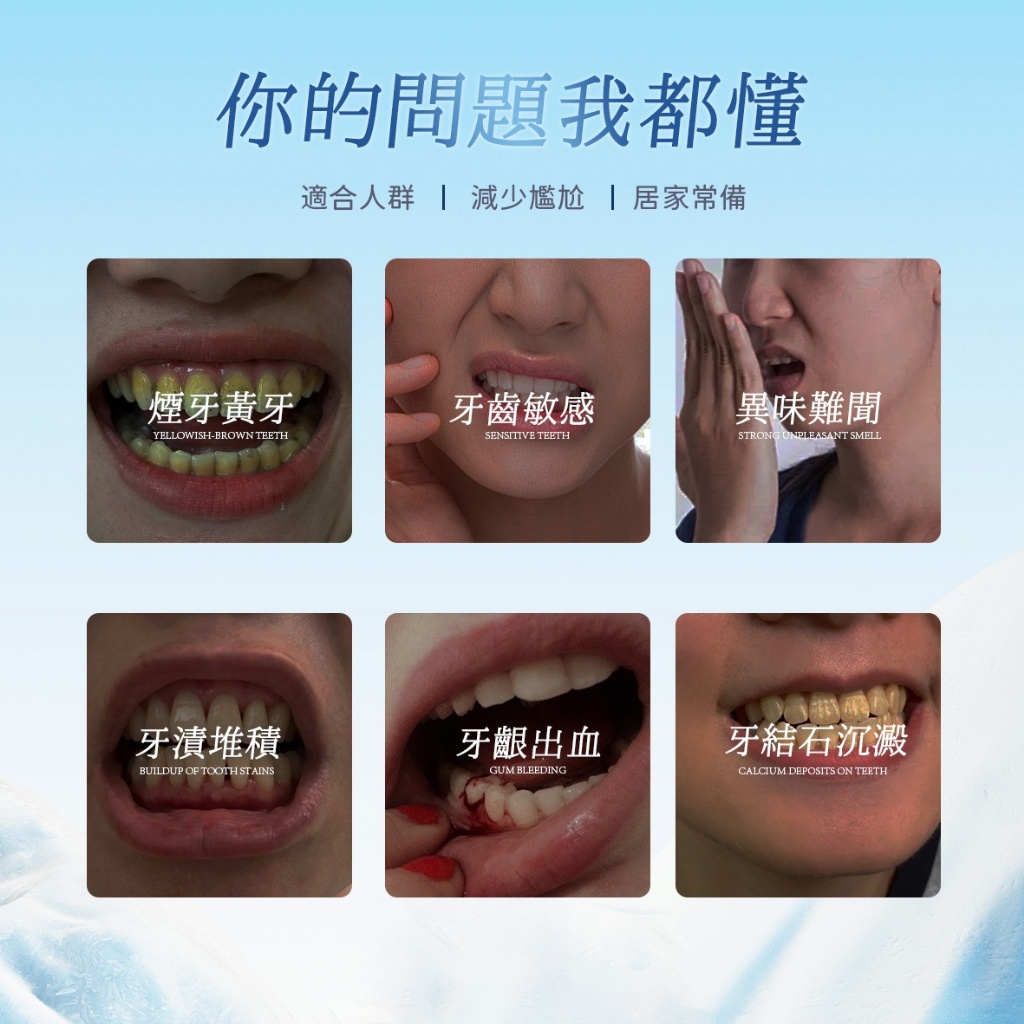 YW260502 - MIZU 益生菌礦鹽除漬牙膏110g(一組三條)