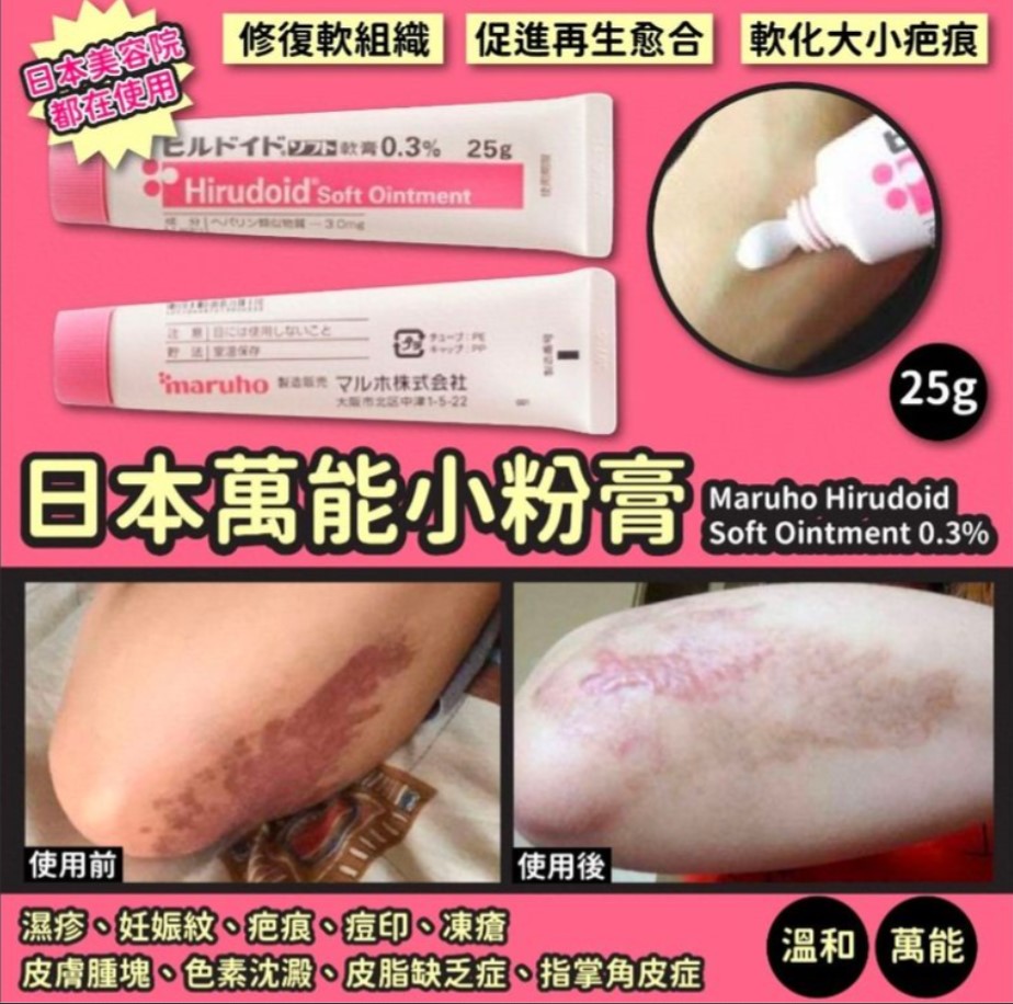 (代購) 日本 Maruho Hirudoid Soft Ointment 0.3% 萬能小粉膏 25g
