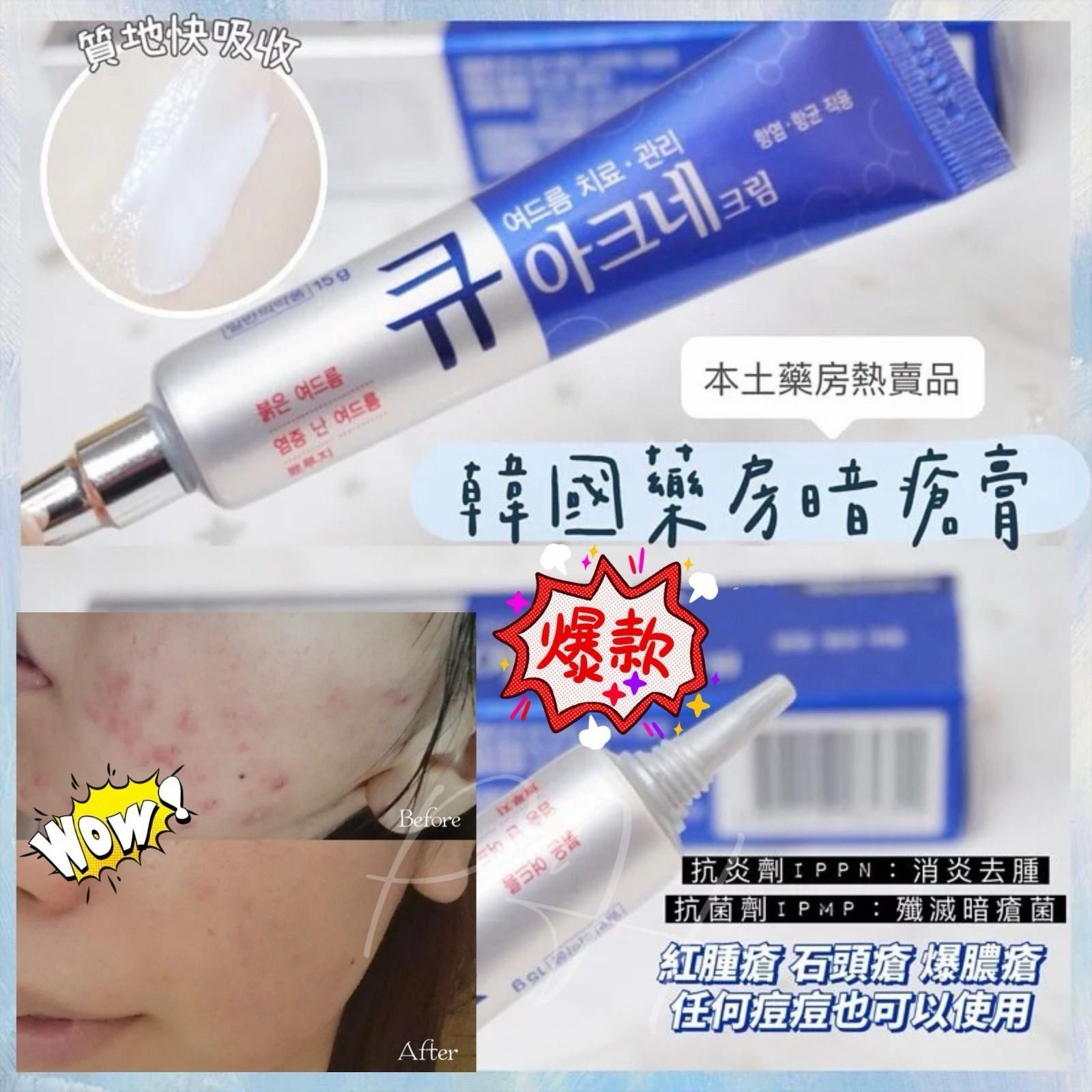 🌸韓國本土藥房熱賣 Q Acne祛痘消炎暗瘡膏15g