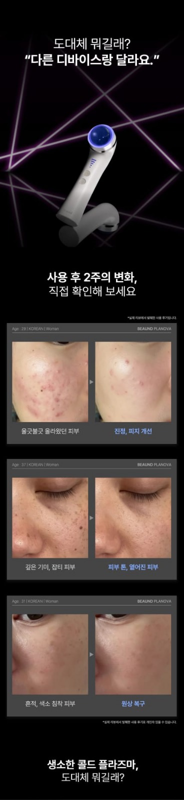 $1150,韓國🇰🇷BEAUND Planova 4合1冷等離子家用護理儀