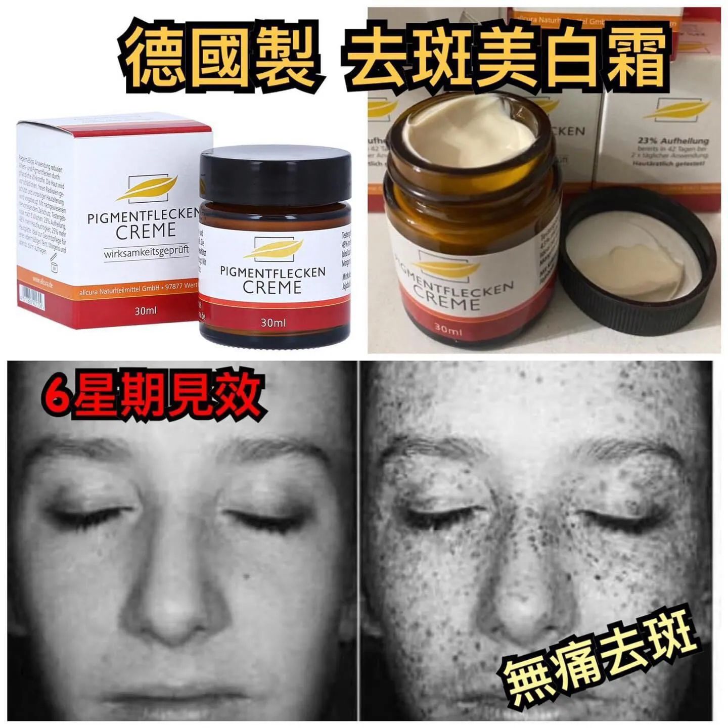 【預訂】德國 Pigmentflecken Creme 去斑美白霜 30ml