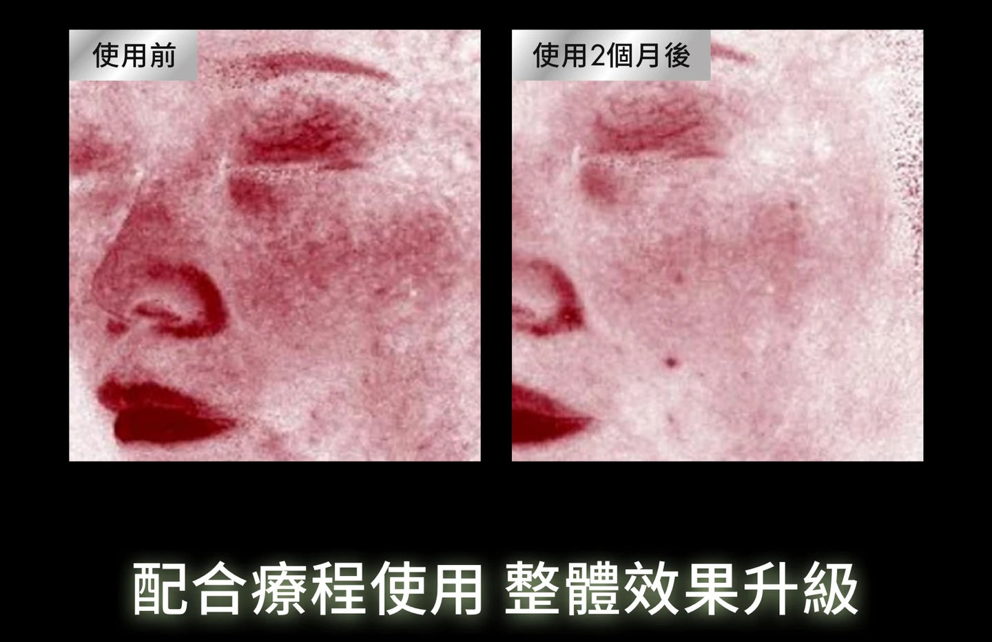 加拿大直送 SkinCeuticals PDRN植萃舒緩修護精華