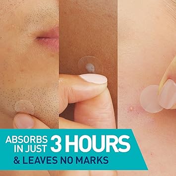 CeraVe - 有效吸油控油暗瘡貼