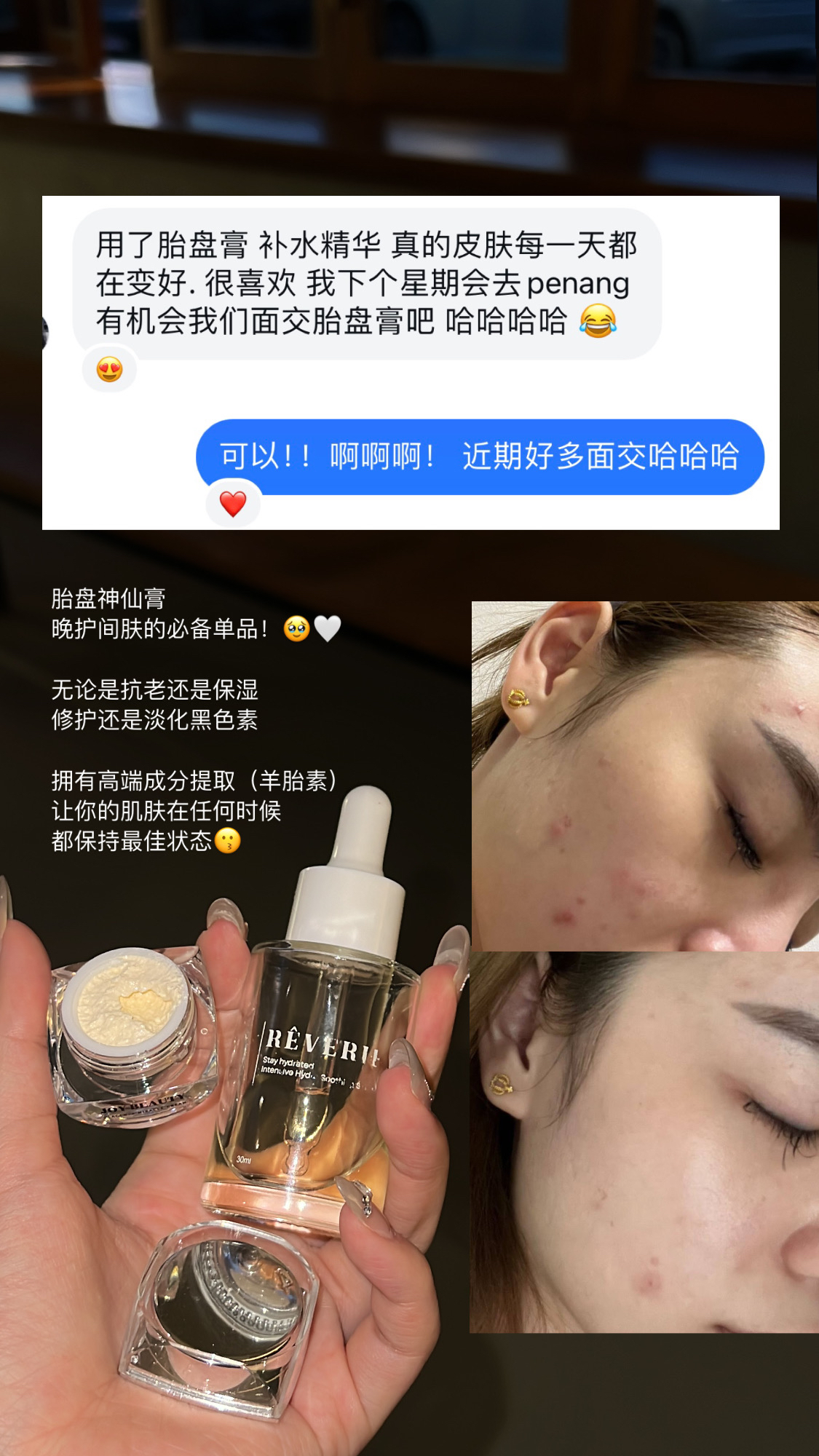 精华+胎盘膏组合（最热销）