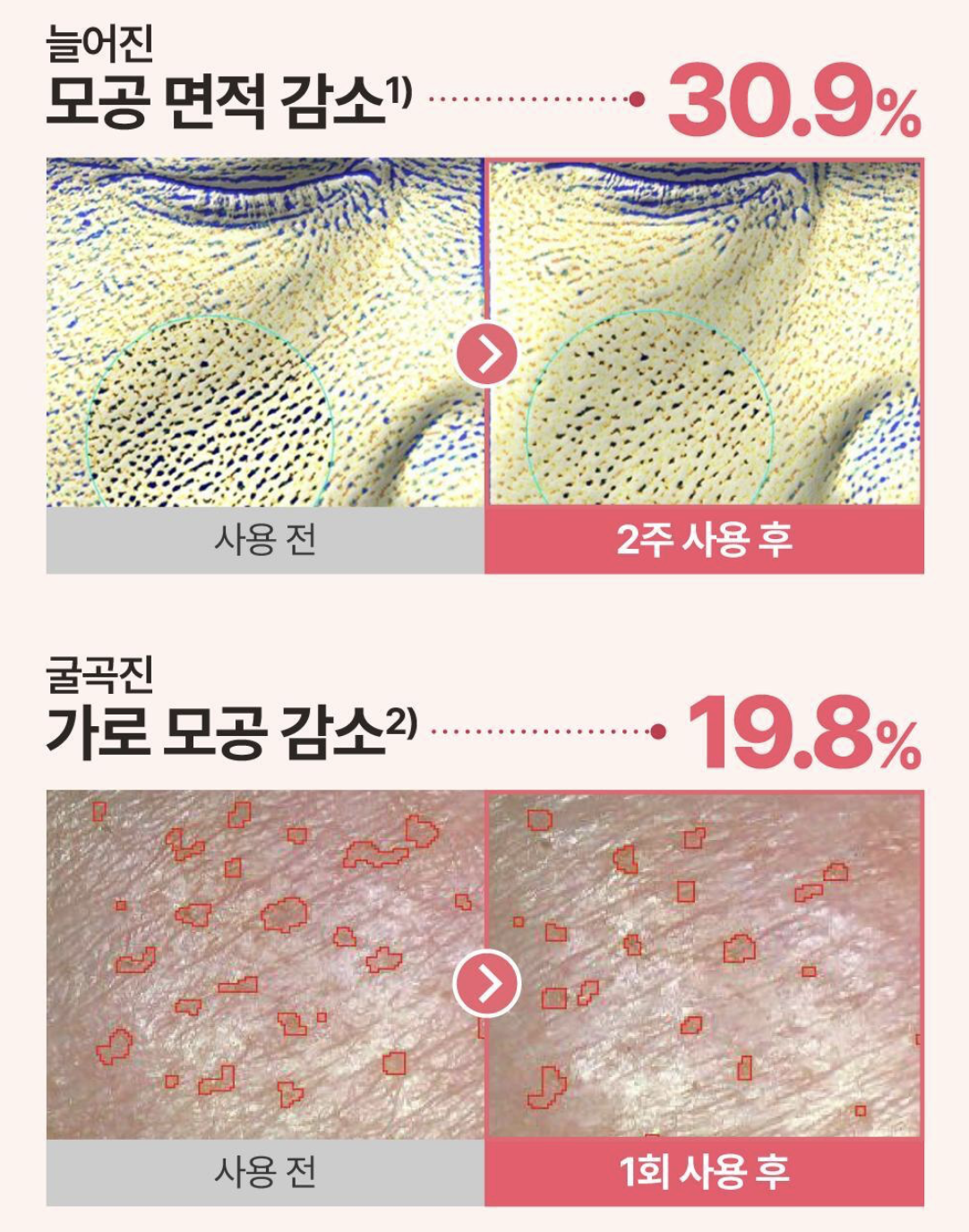 韓國 Numbuzin X 土豆熊 3號柔滑嫩膚 酵母精華 50ml +50ml +減壓波波｜No. 3 Skin Softening Serum