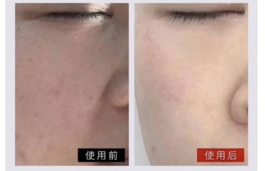 *【🇯🇵日本最強整形醫院SBC湘南監製 - 湘南美白霜10g】*