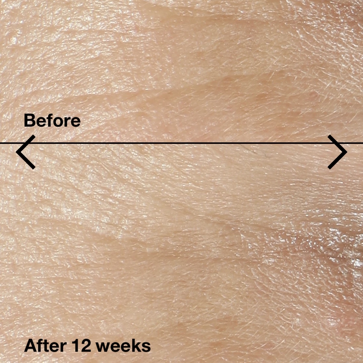 Clinique  Smart Clinical Repair™ Wrinkle Correcting Cream 倩碧激光活膚緊緻乳霜 1870紫光面霜50ml 