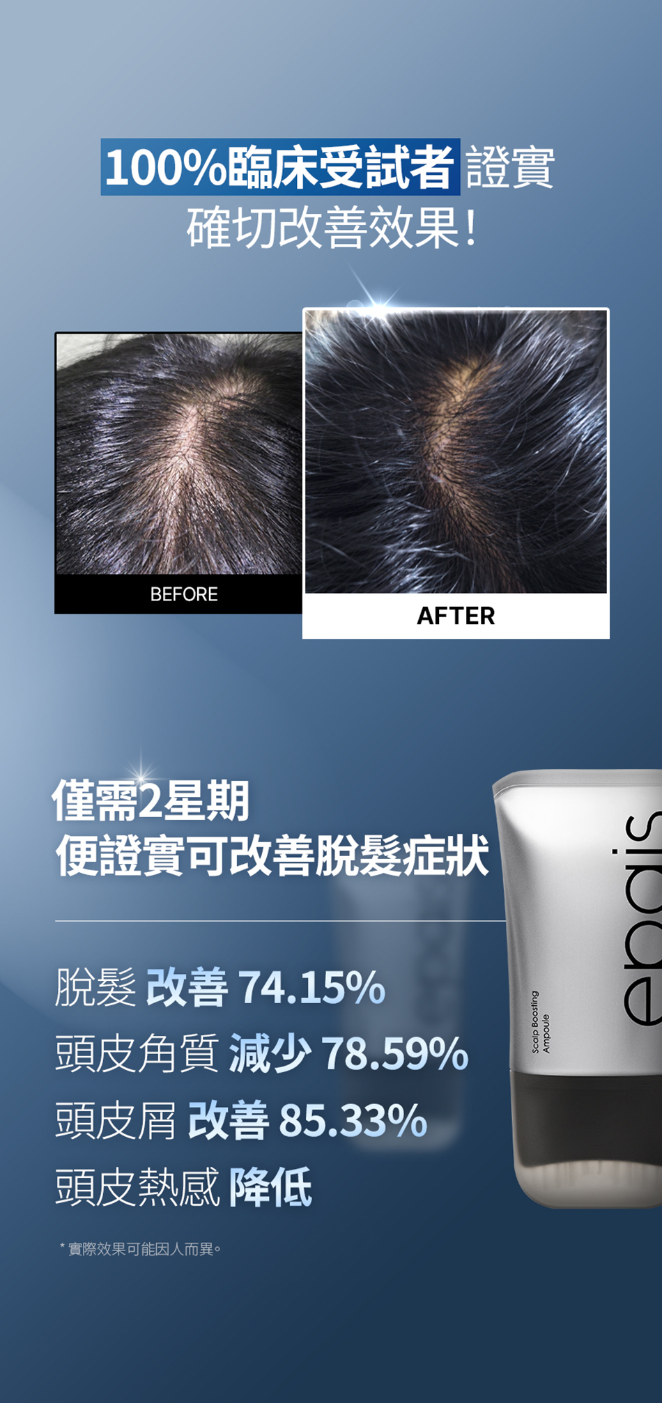 韓國🇰🇷直送✈️Epais Scalp Boosting Ampoule 強韌髮根頭皮精華 150ml