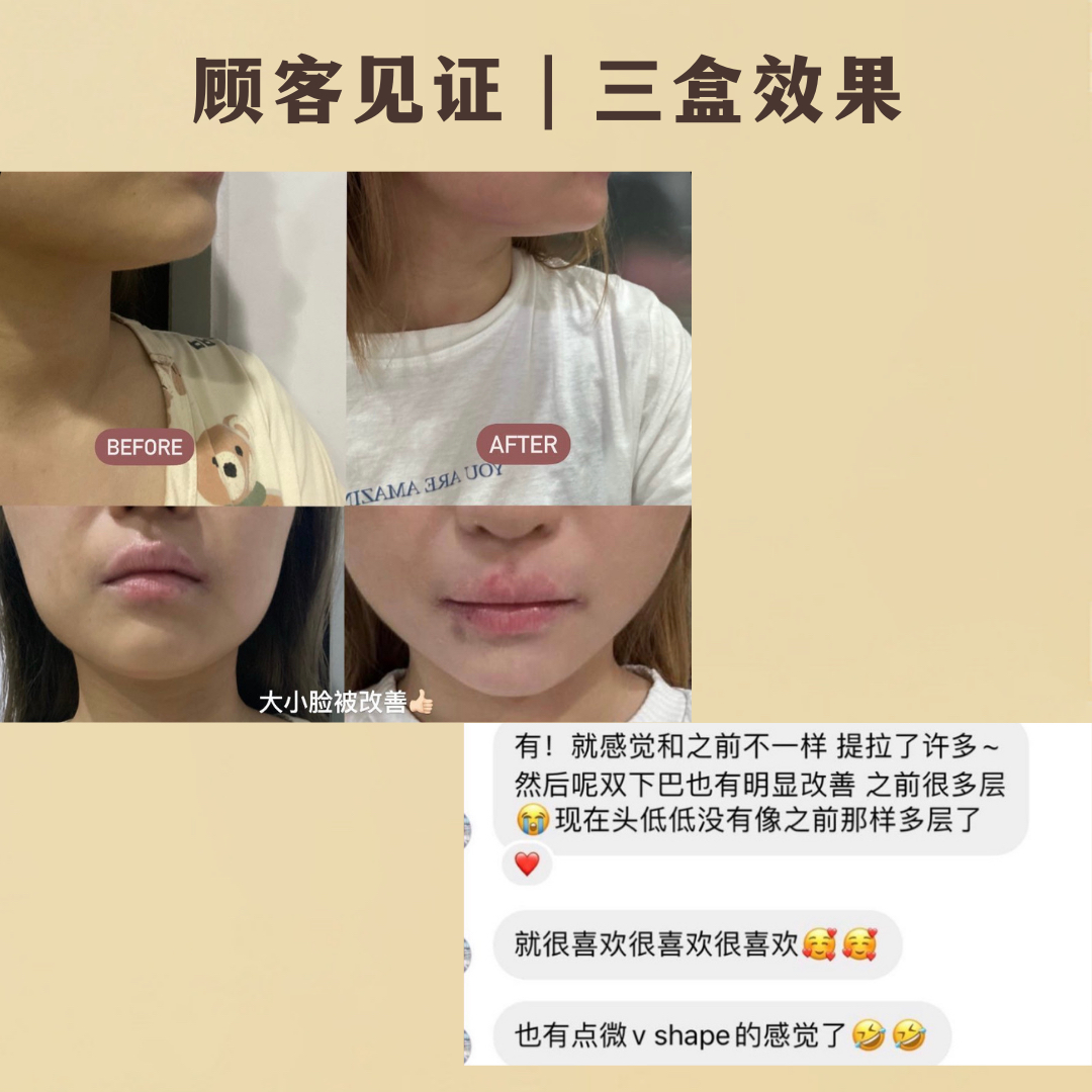 REVERIE瘦脸面膜-热销款