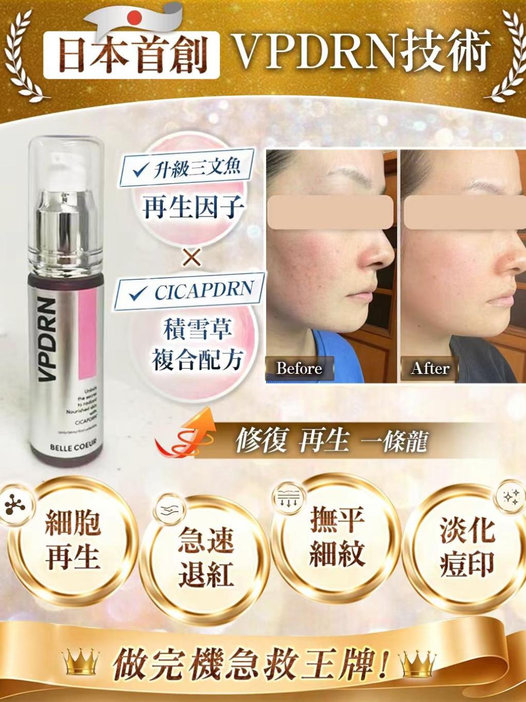 日本🇯🇵BELLE COEUR首創VPDRN精華