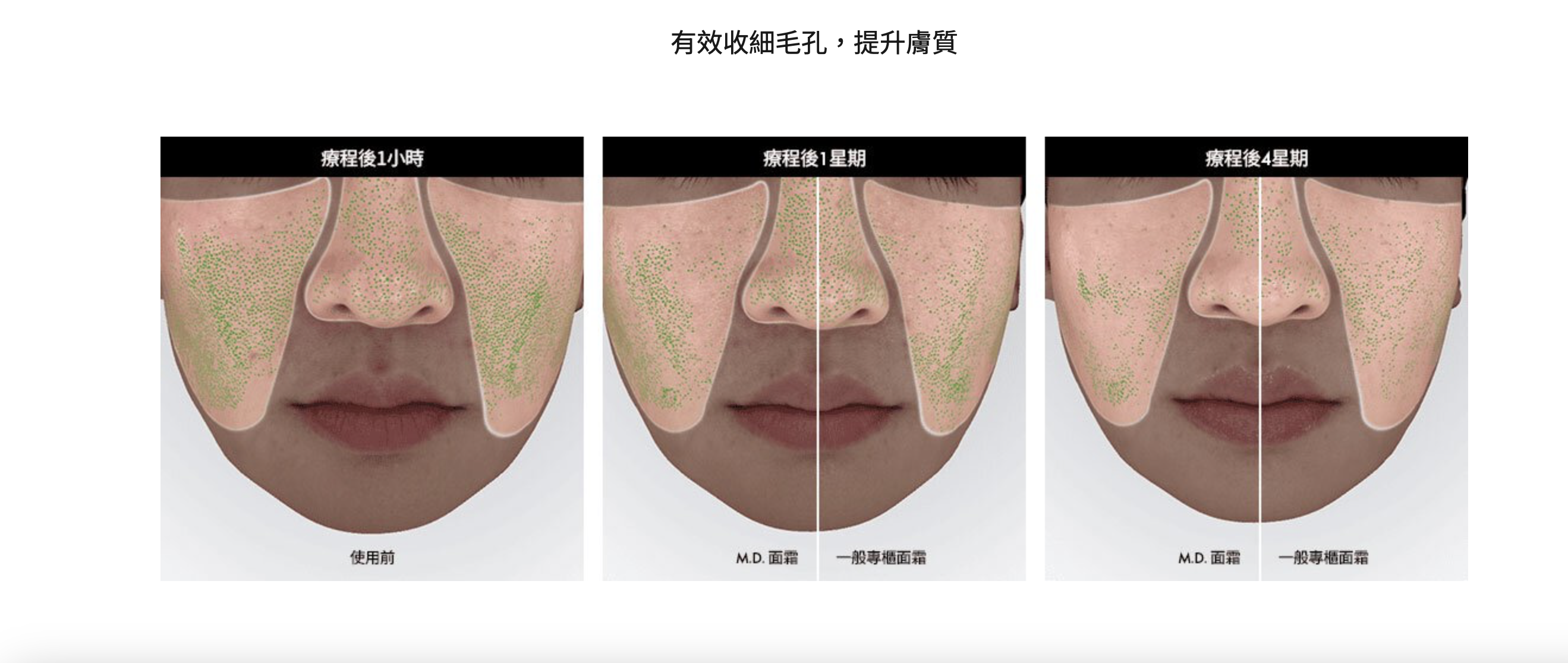 AP Beauty 膠原重建緊緻雙效面霜 Dual Repair Lift Cream 50ml
