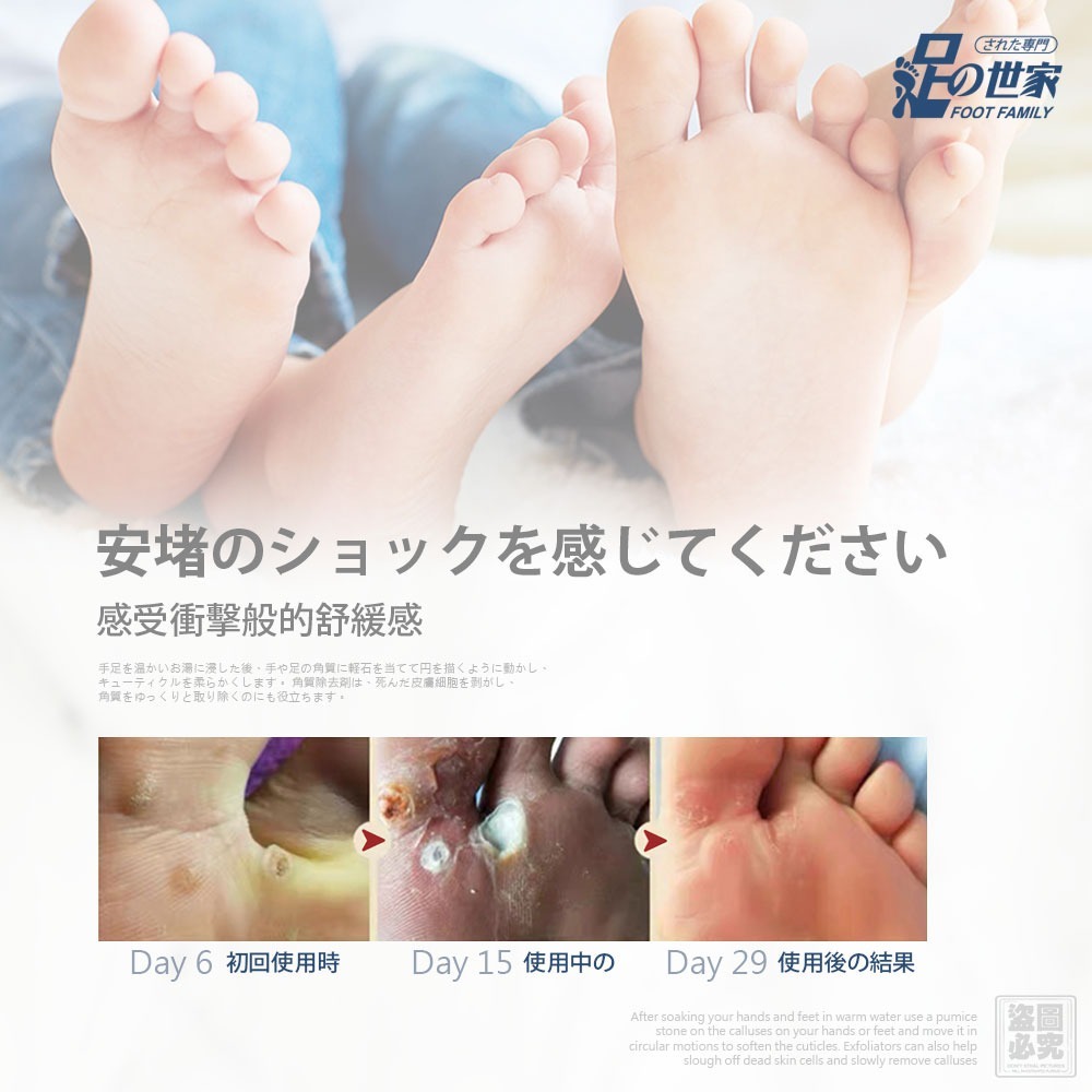 用於治療腳部老繭和雞眼的貼片。