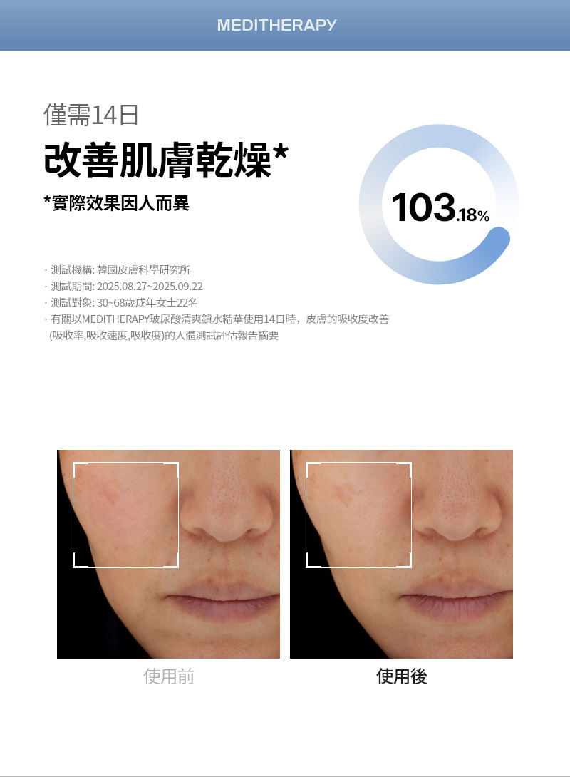 Meditherapy 333玻尿酸保濕精華 150ml 