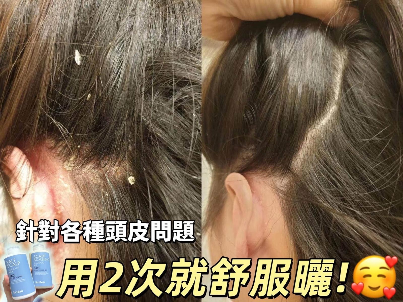 韓國🇰🇷直送@限時預購🔛RUTHAIR 3重海鹽天然潔淨脂漏性頭皮調養洗護系列300ml