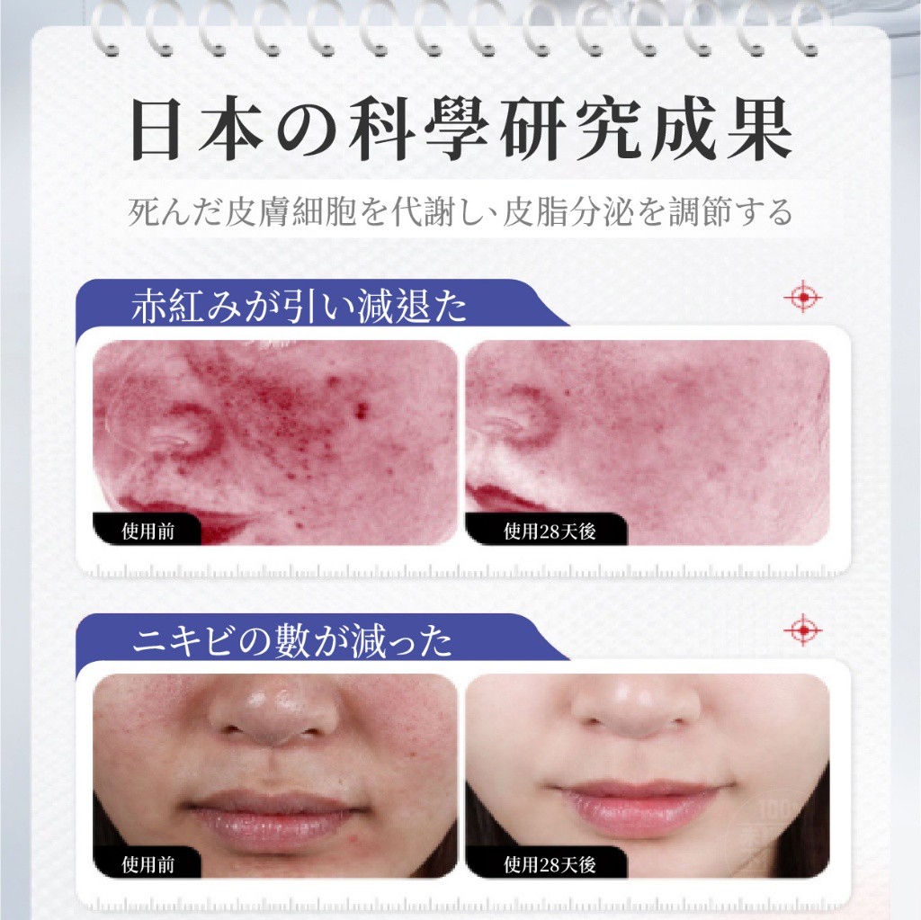 *DR.ITAYA®️ Acne 袪荳軟膏 30ml*