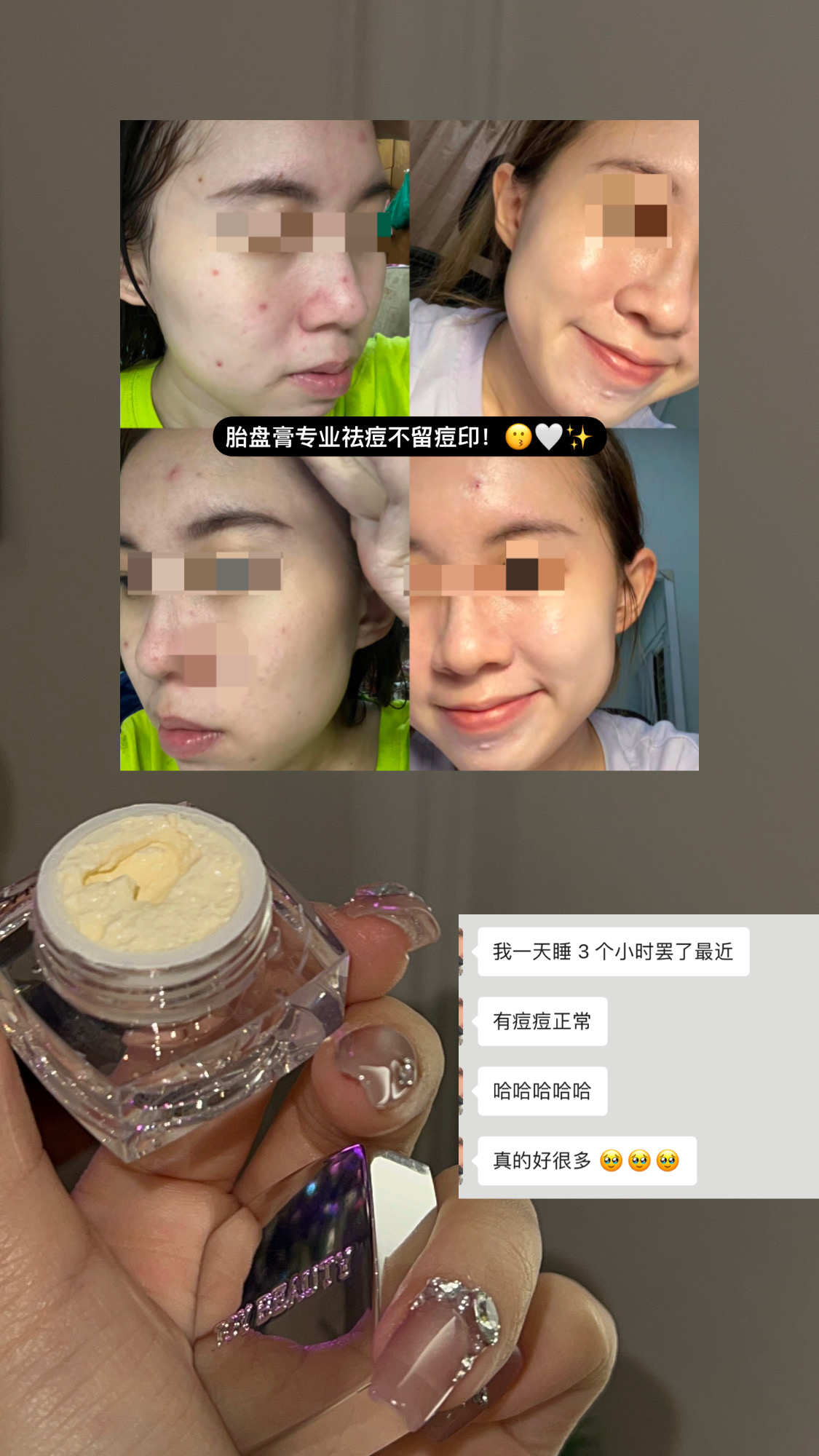 胎盘膏  5g体验装