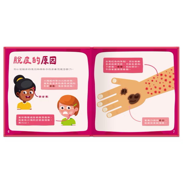 【點讀版】身體又來了！我為什麼會脫皮？