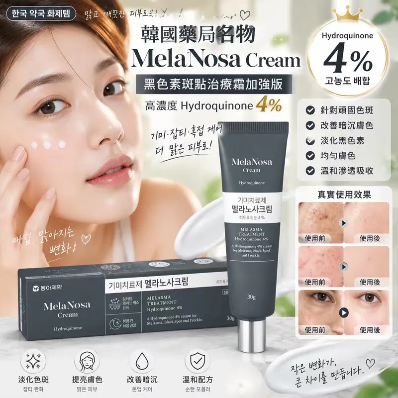 韓國 MelaNosa Cream 黑色素斑點治療霜加強版 30g