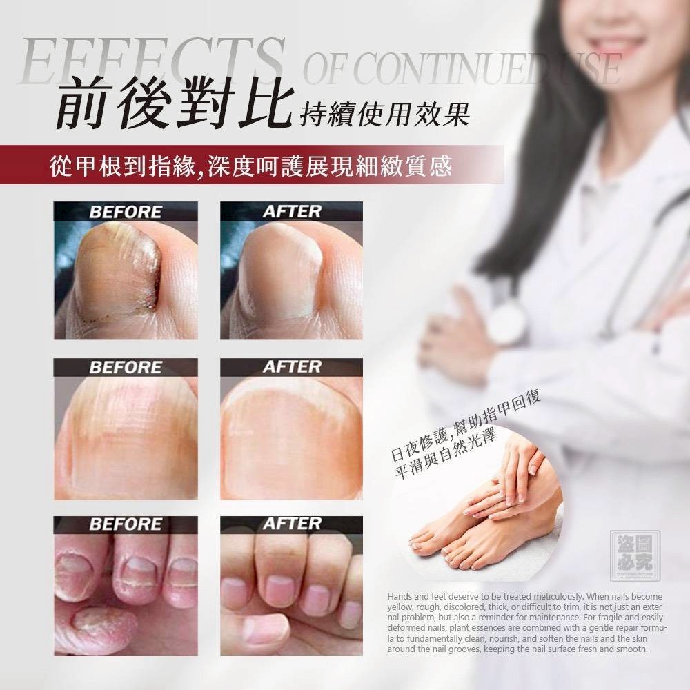 ＜限時預購＞ MIT 灰指甲滋養膏15ml TW260824S02 《28/8截單，預計10月下旬到港》