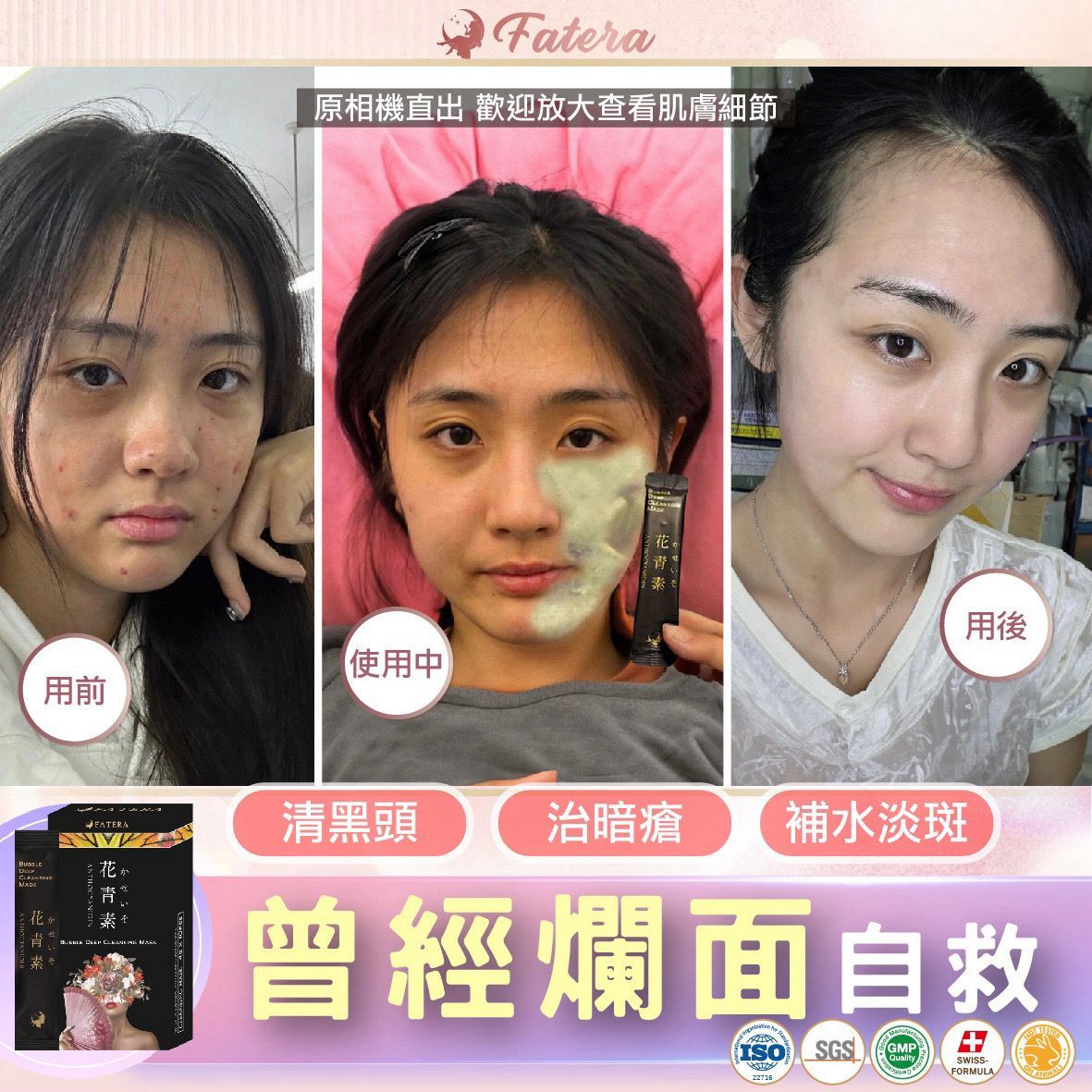 𝐅𝐚𝐭𝐞𝐫𝐚花青素小氣泡面膜（一盒10片）