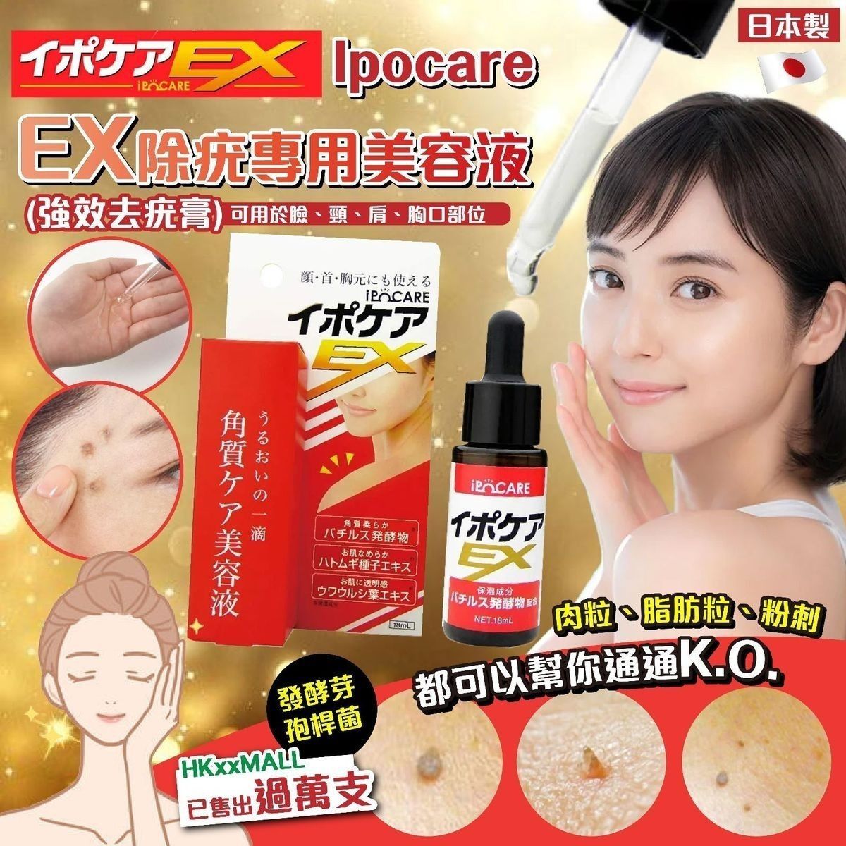 ＜限時預購＞ 日本Ipocare EX除疣專用美容液18ml  TW260410L02 《12/4截單，預計5月中旬到港》
