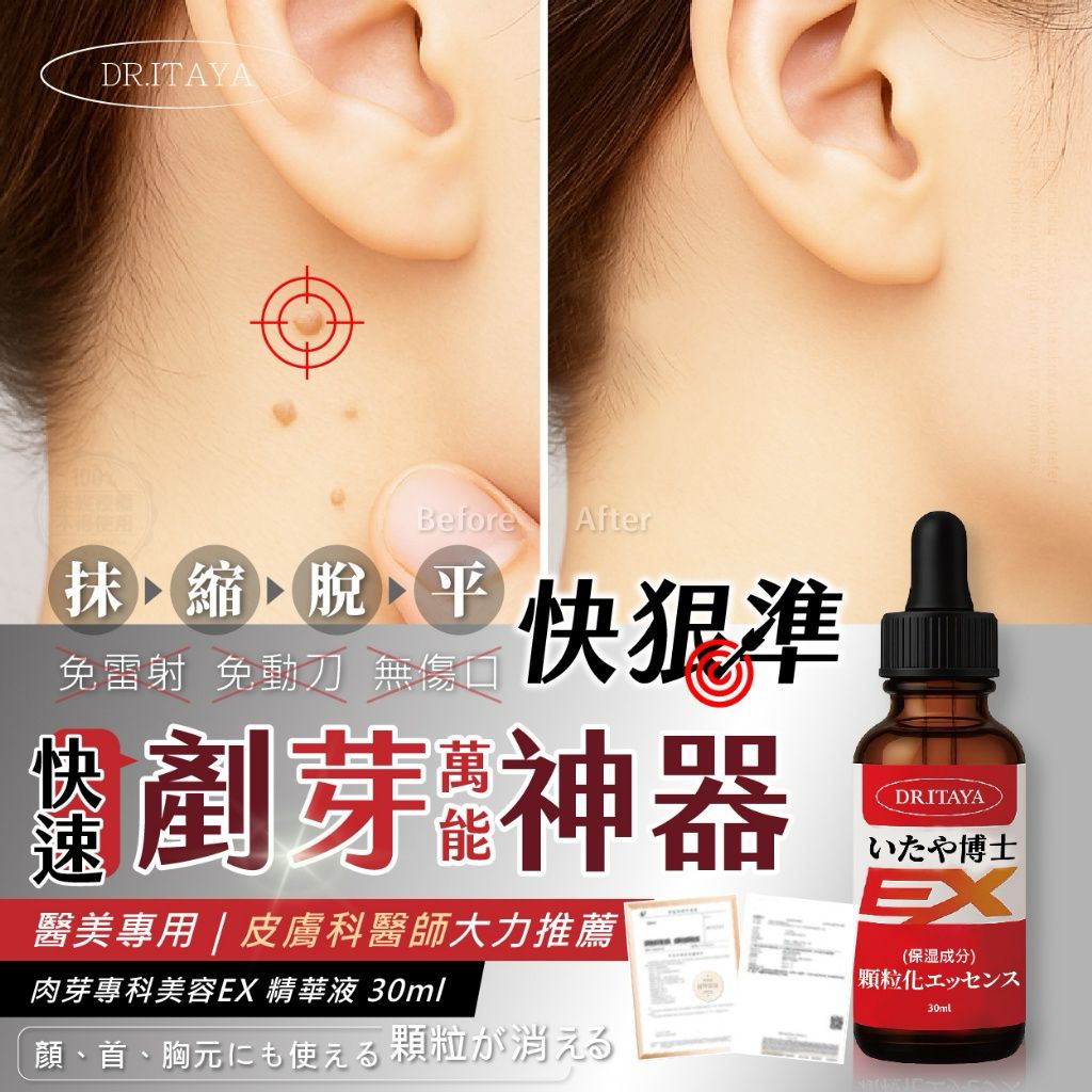 【預訂】台灣 DR.ITAYA 肉芽專科美容EX精華液 30ml