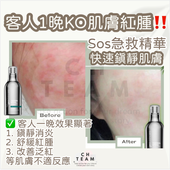 【 萬用急救修復精華 】SOS急救精華