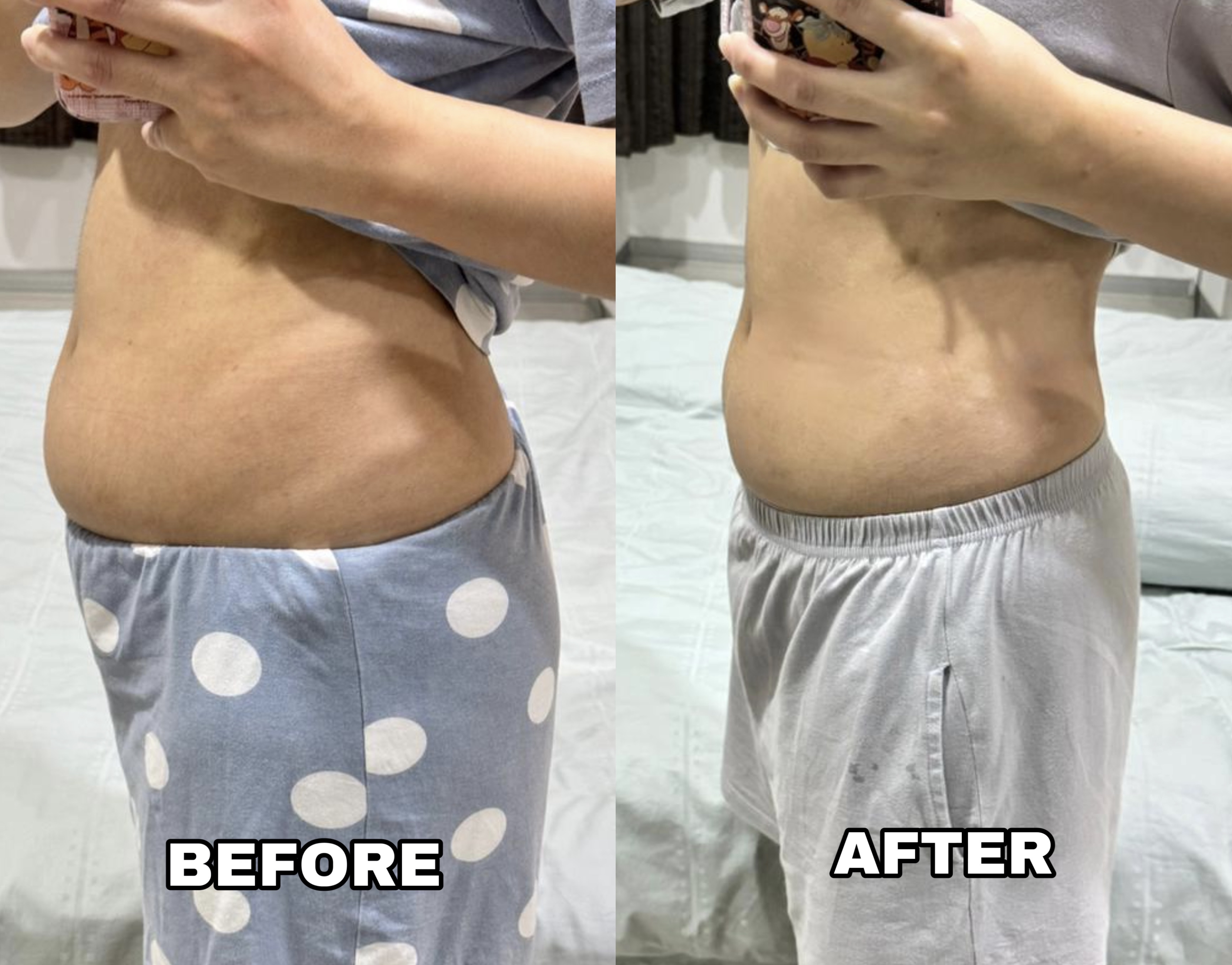 🇲🇾 10 盒 最畅销 VVIP 疗程配套（ 可服用 60-75天 ）