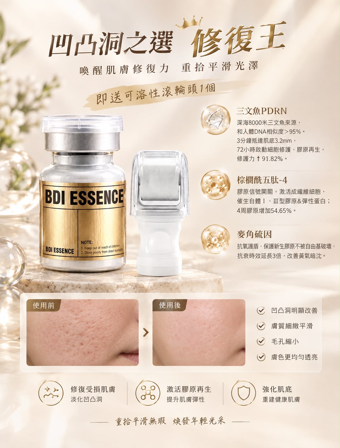 BDI ESSENCE 凹凸洞修復王