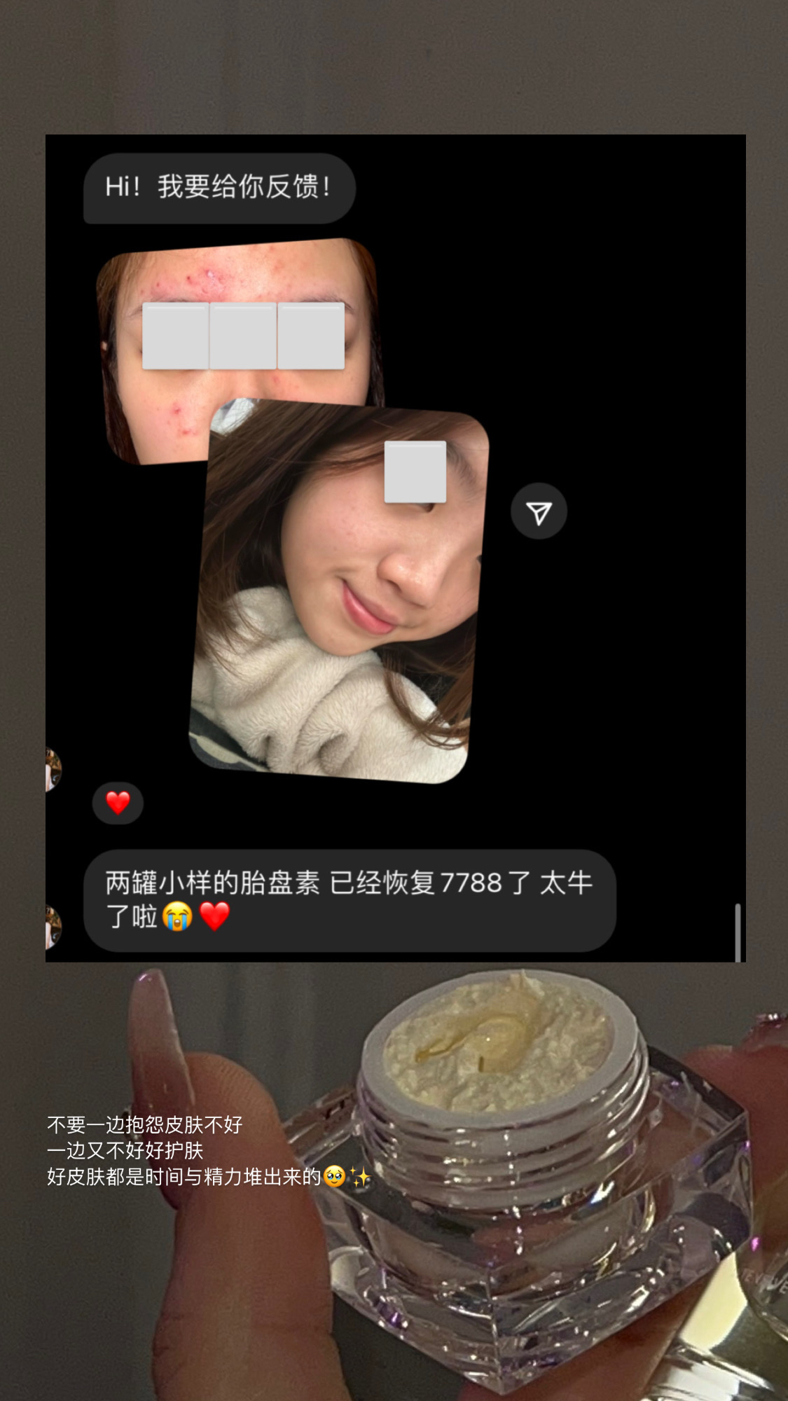 胎盘膏  5g体验装