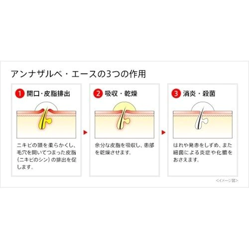 小白兔 ANAZARU 青春痘膏 18g【小編極推】