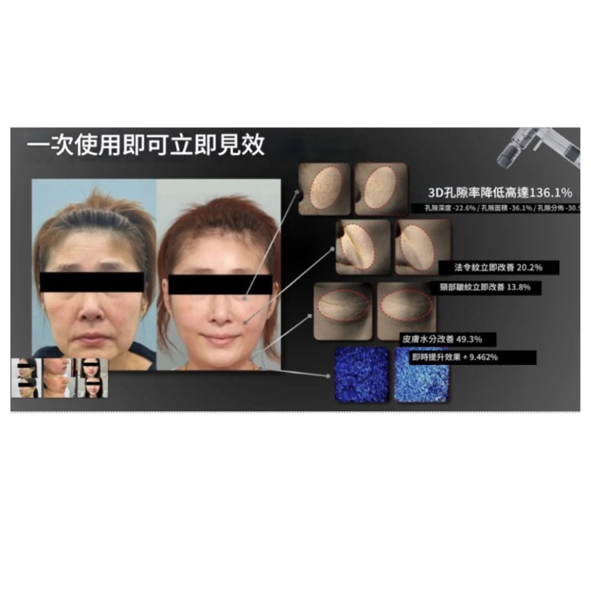 Pion-Tech V微針3D提拉緊緻塑形蜘蛛面膜40g