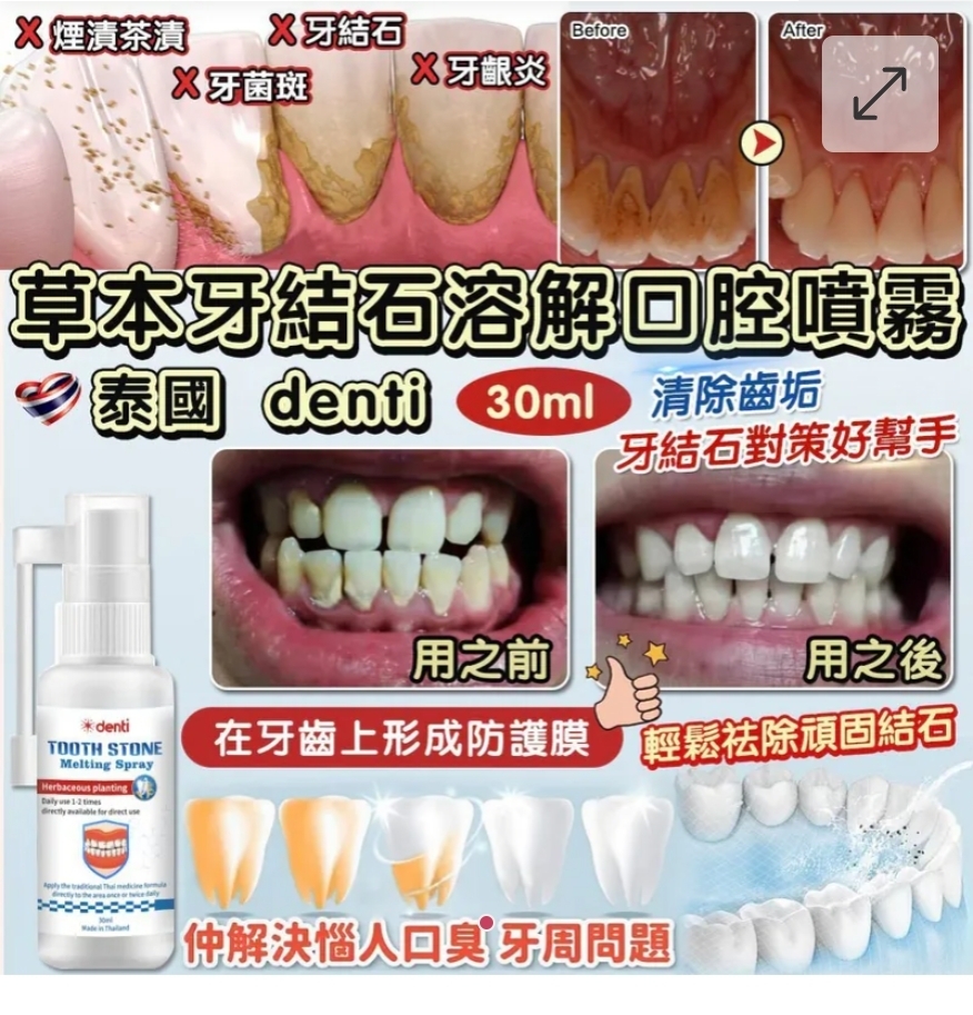$55支,2套以上$45支 ,泰國 Denti 草本牙結石溶解口腔噴霧 30ml (單支)