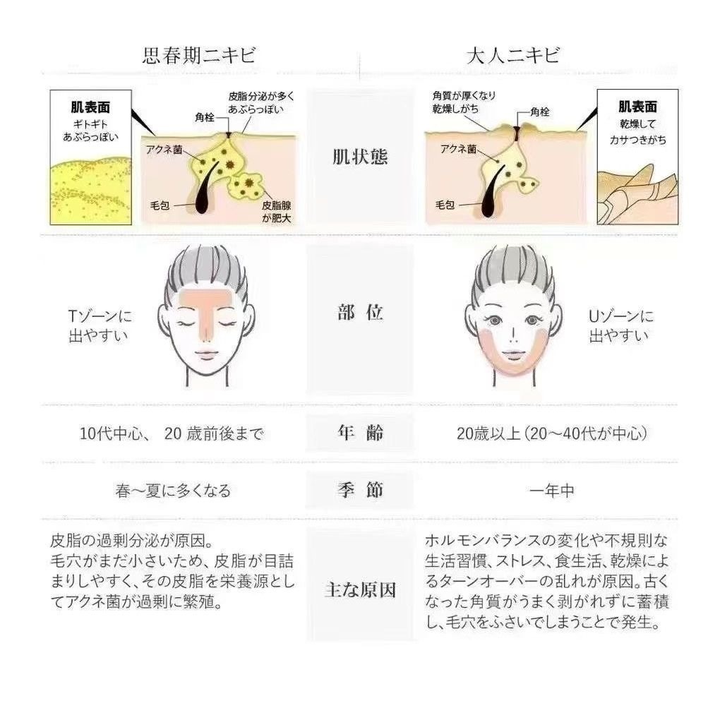 日本專業院線 🇯🇵 JOLI  🤍 藥用祛痘精華液 105ml