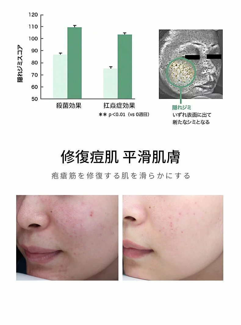 雙11大優惠💯日本製🇯🇵Ystella袪痘泡沬潔面霜120g❤️買一送一❤️再送10支NMN精華  