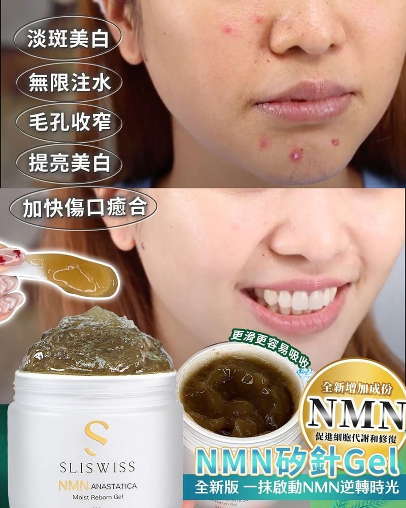 瑞士Sliswiss │ 白藜蘆醇NMN矽針Gel (最新升級版3.0)｜300ml｜凹凸痘肌救星｜無痛都做到矽針｜消炎去暗瘡印｜極速消滅暗瘡暗粒