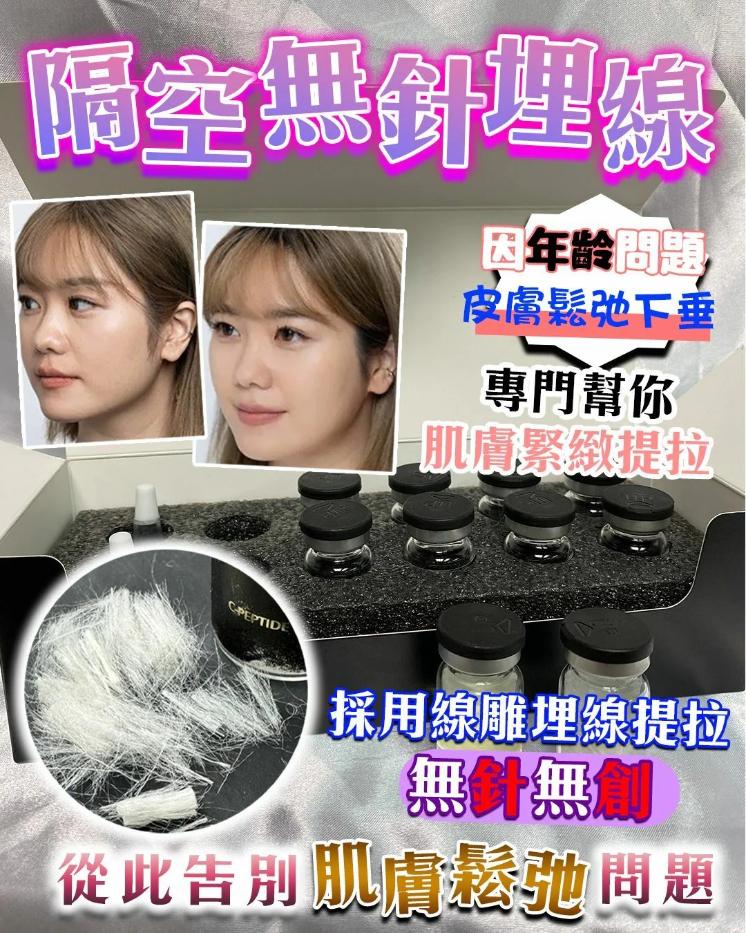 Neuface Pro 全新第5代隔空無針埋線升級版  (訂貨4-7天)