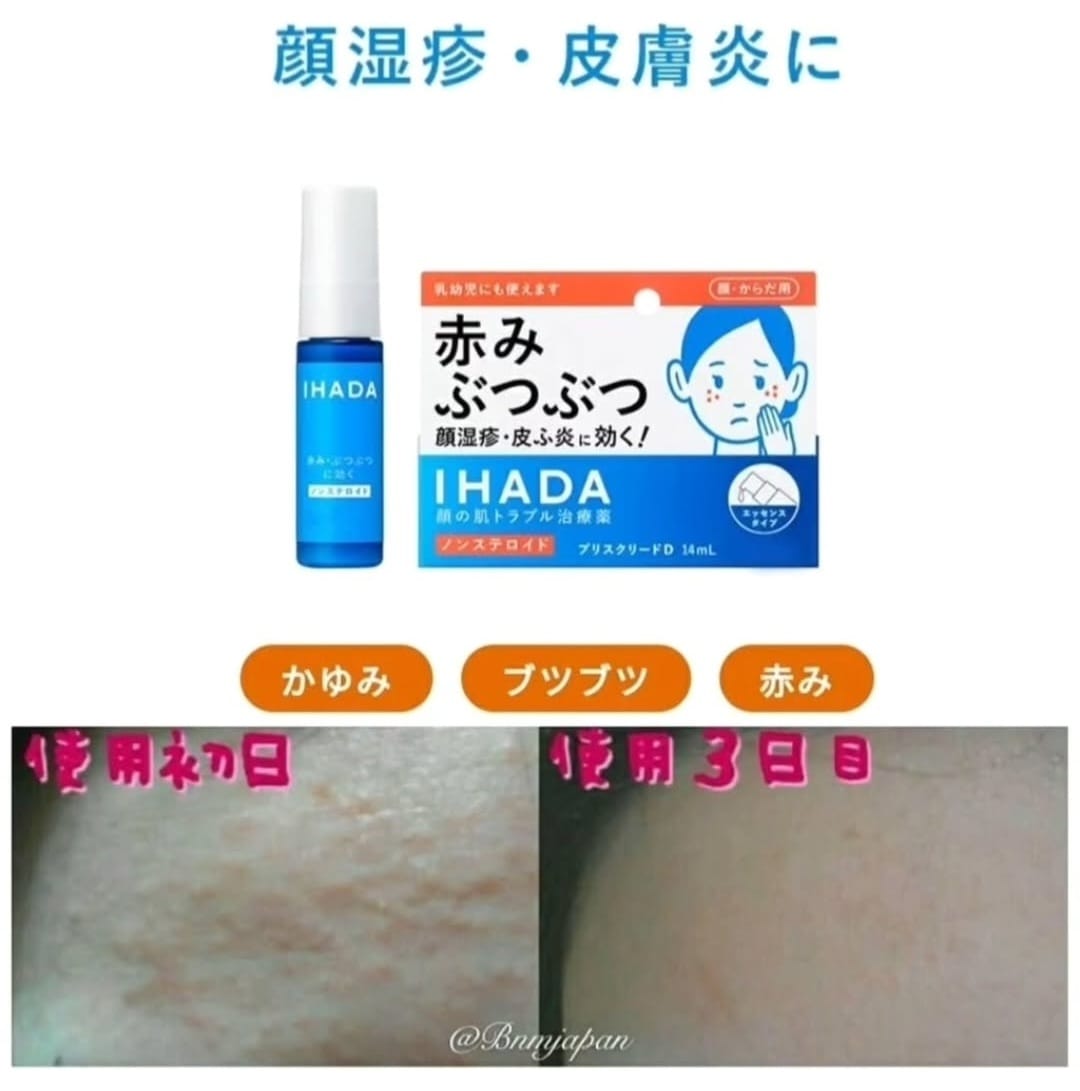 日本資生堂IHADA顏濕疹皮膚炎藥液