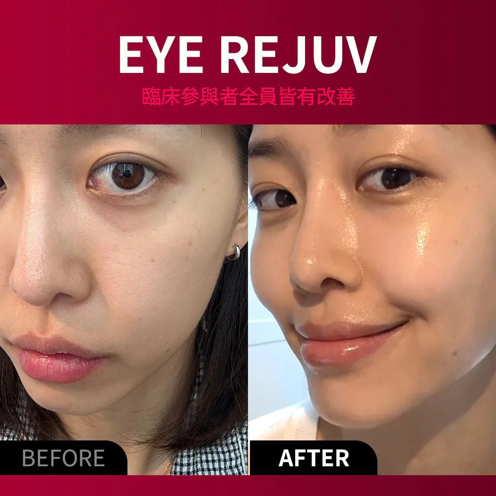 $630套。Olive Young Big Sales BEAUND Eye Rejuv 眼部煥顏抗皺護理儀