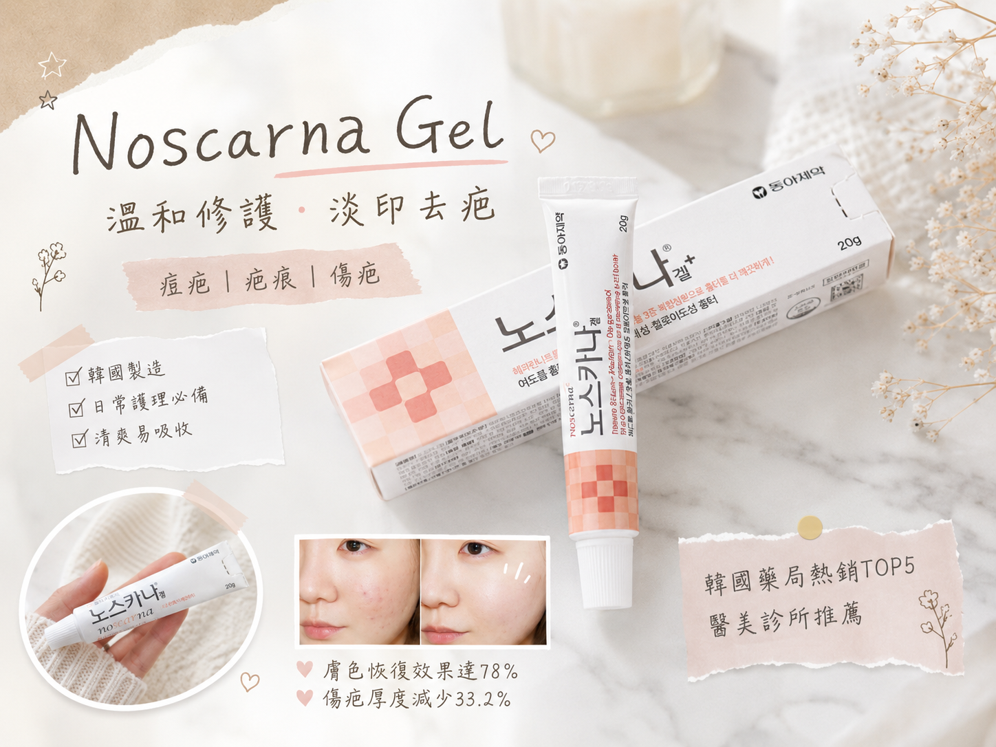 「去印修復神器」Noscarna Gel 祛疤去印膏 (有兩個size 的 10g / 20g)