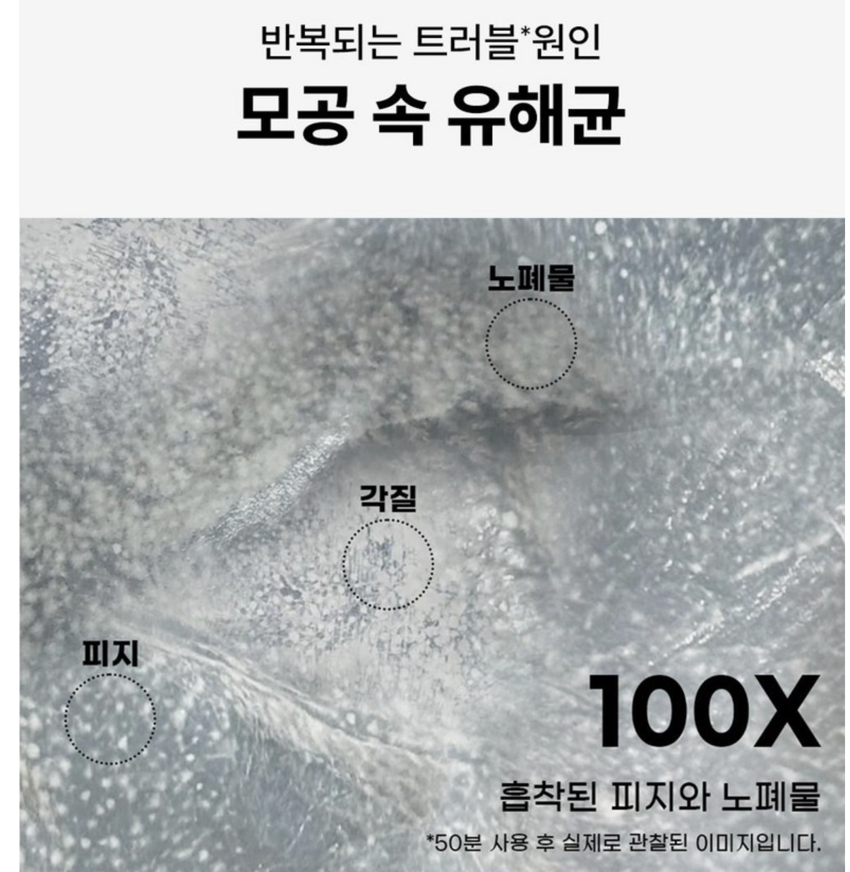 消炎吸皮脂｜韓國 EIOM 消炎祛痘 淨膚面膜 4片/盒｜Trouble Patch Mask