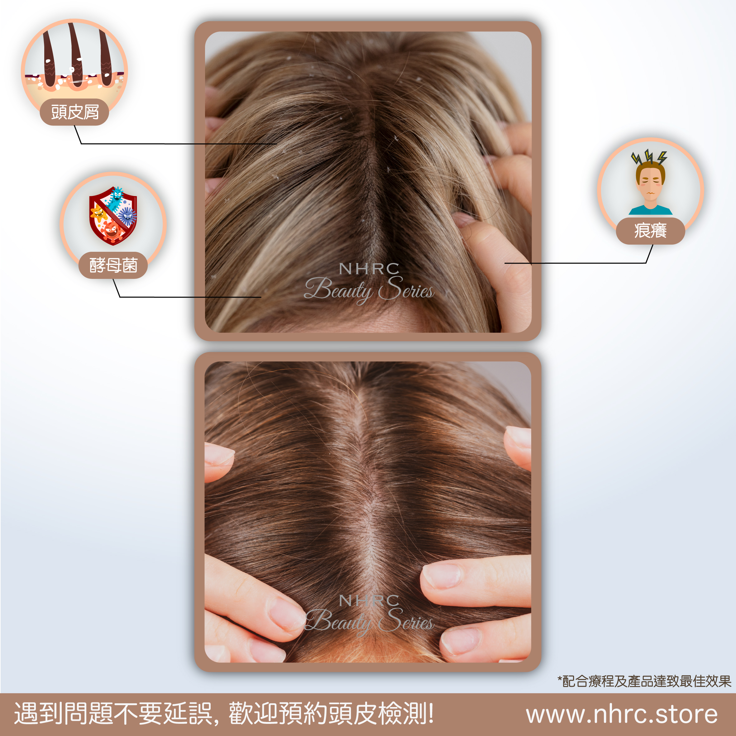 頭皮淨化抗菌去屑洗頭水 Hair Purifying Shampoo