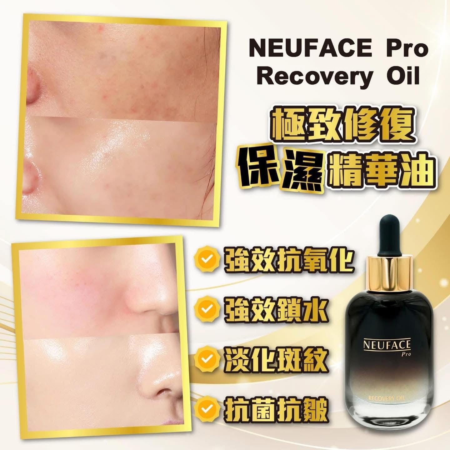 NEUFACE Pro Recovery Oil 30ml