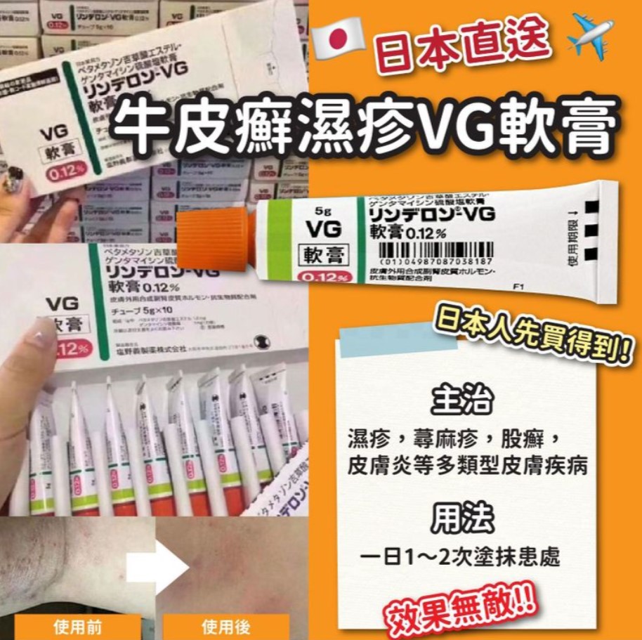 (代購) 日本 VG 牛皮癬 濕疹 軟膏 5g